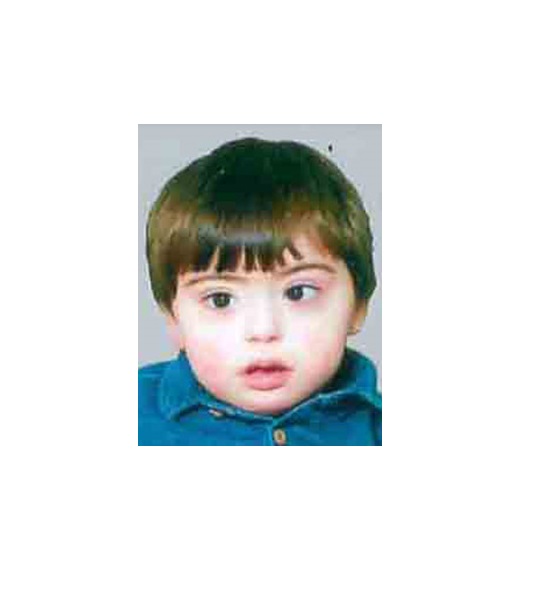 Orphan Taha suffers from Down Syndrome